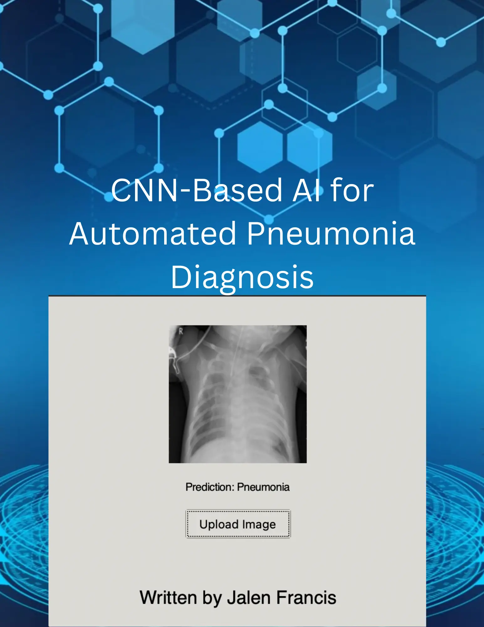Pneumonia Classification CNN